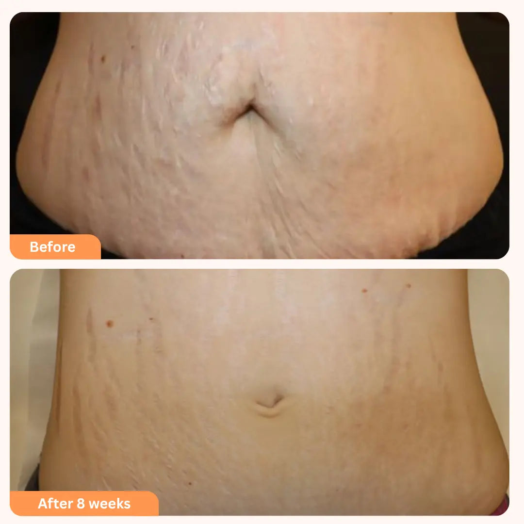 Tighten & Smooth Body Cream relivra™