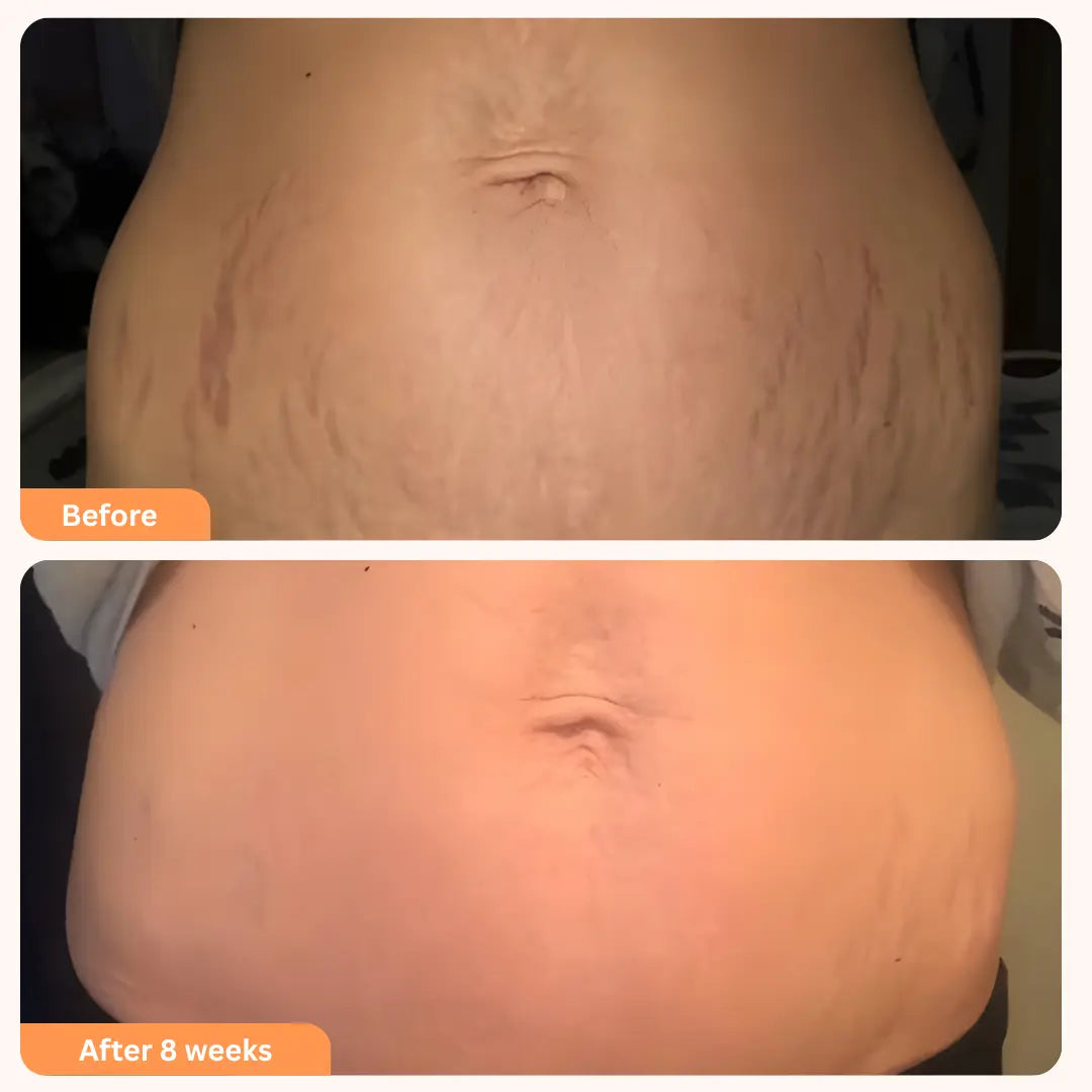 Tighten & Smooth Body Cream relivra™