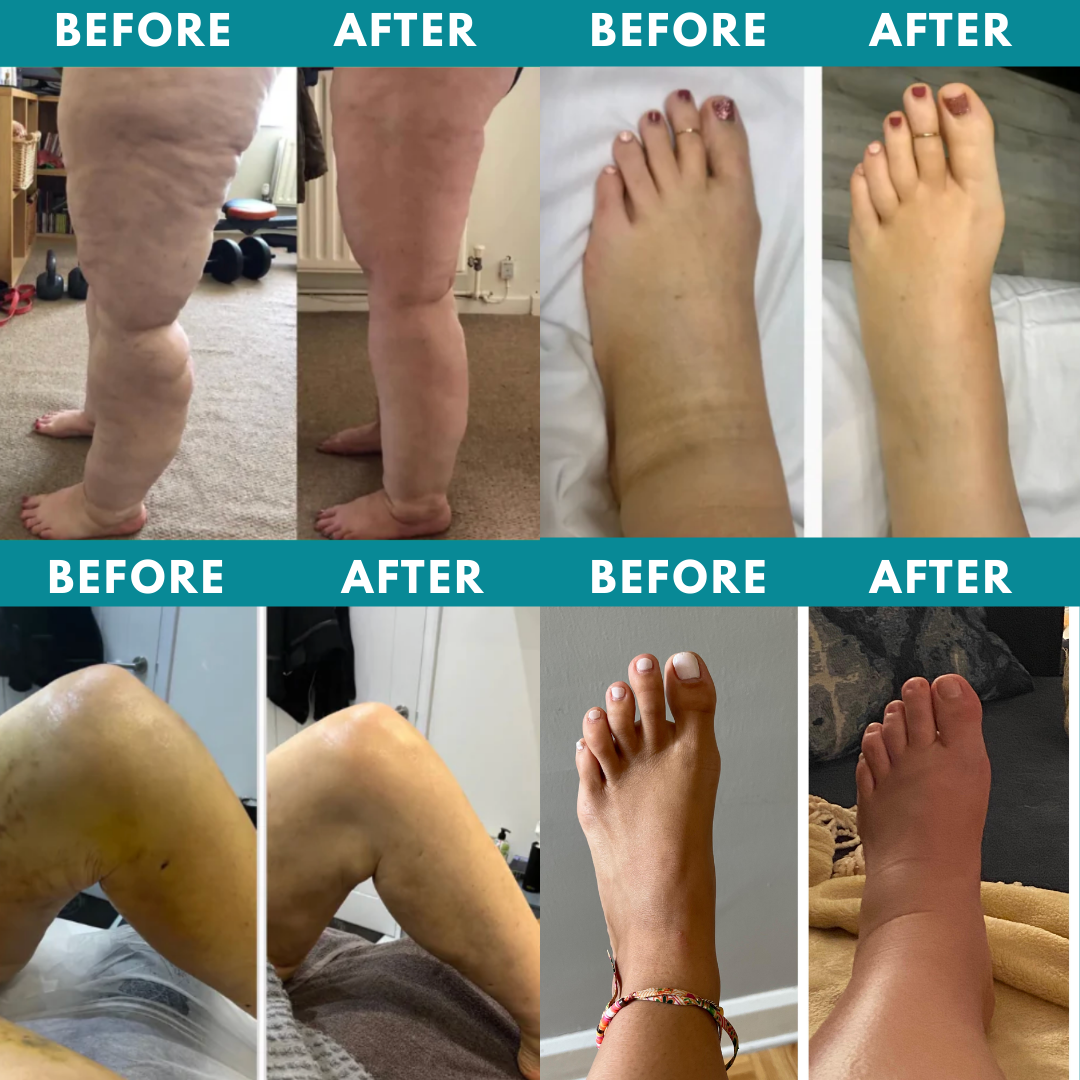 relivra™ - Heat And Pressure Leg Massager (1pc)